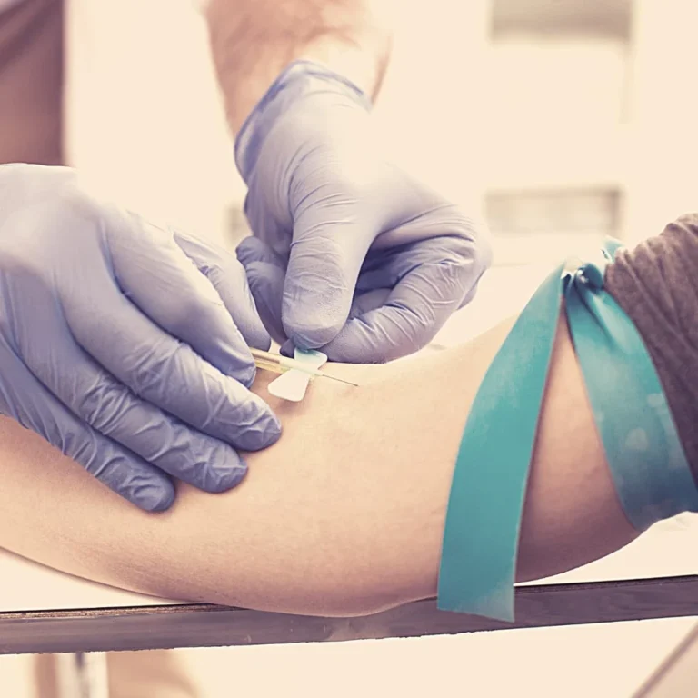 Postpartum Glucose Test After Gestational Diabetes