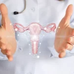 Adenomyosis