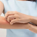Top 5 Causes of Vaginal Itching