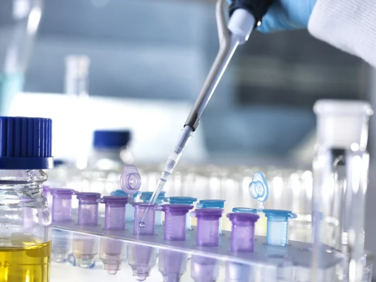How to know if you have PCOS or Polycystic Ovarian Syndrome?