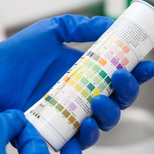 Neon Yellow Pee – What Causes It?