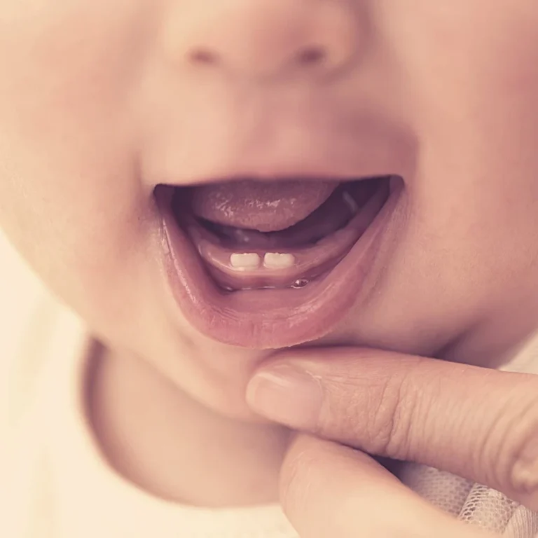 Do Babies Sleep More When Teething