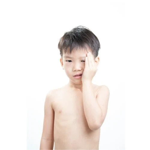 Preventing Eye Injuries in Children: Advice from a Cornea Specialist