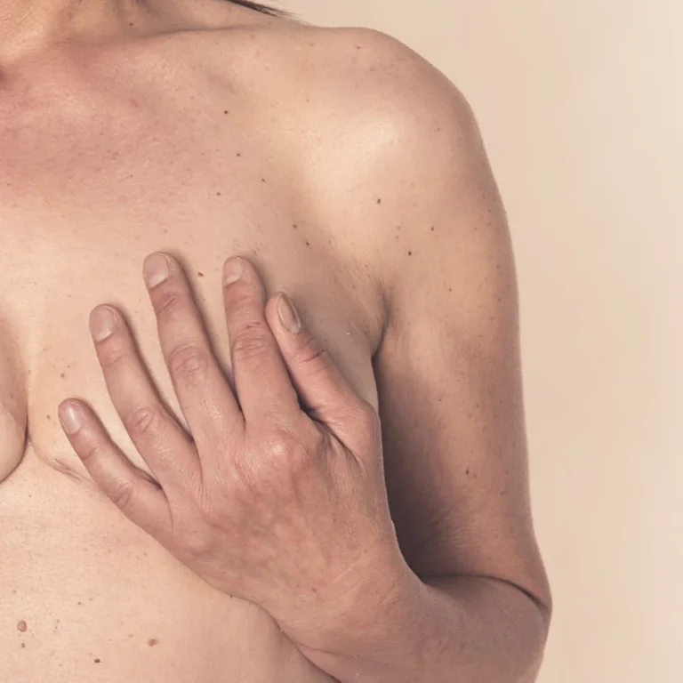 Symptoms Of Breast Cancer