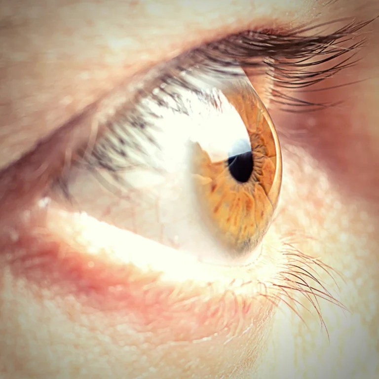 Thyroid Eye Bulging And More Thyroid Eye Disease Symptoms