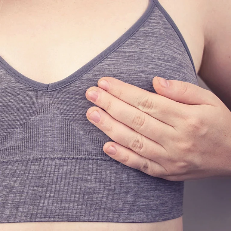 Fibroadenoma On Breast