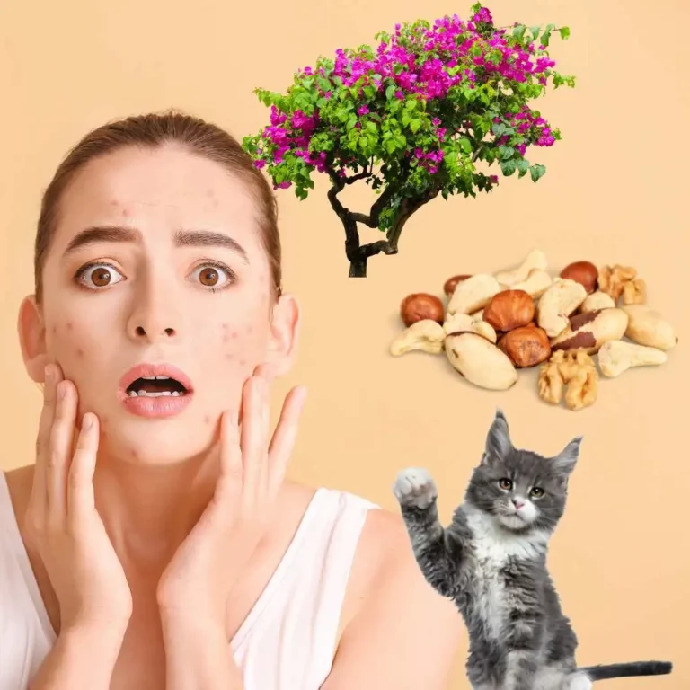 Can Acne Be Caused By Allergies? Causes And Treatment